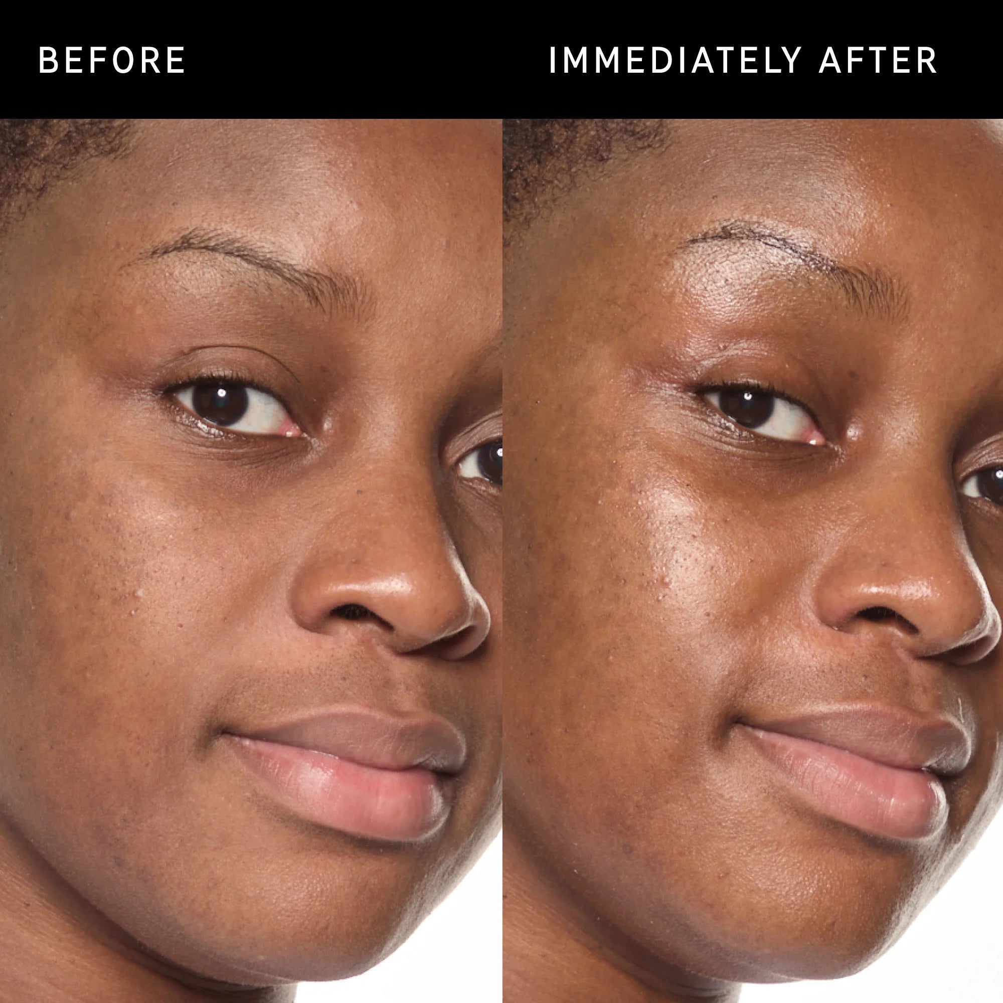 The Inkey List Ectoin Hydro-Barrier Serum