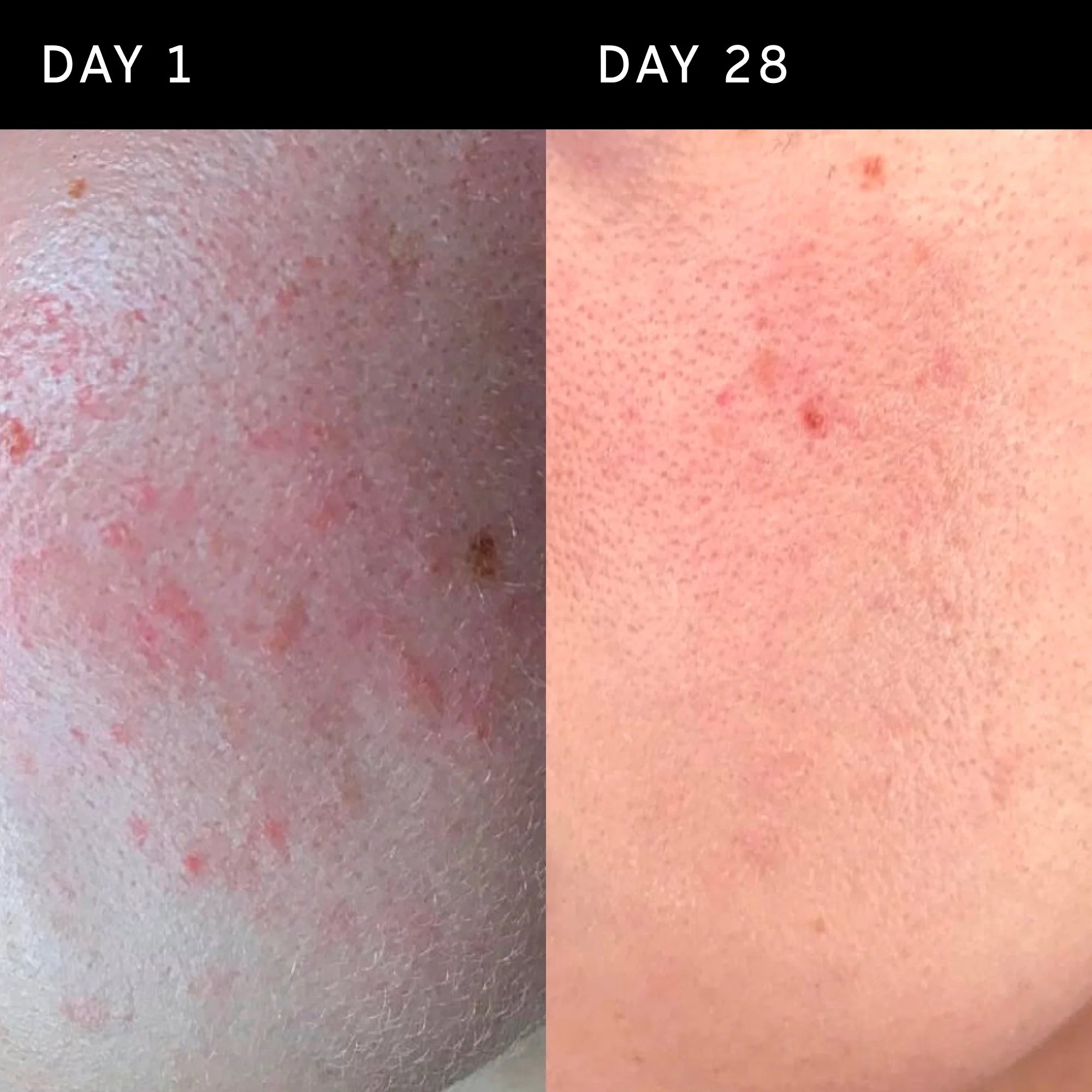 The Inkey List Ectoin Hydro-Barrier Serum