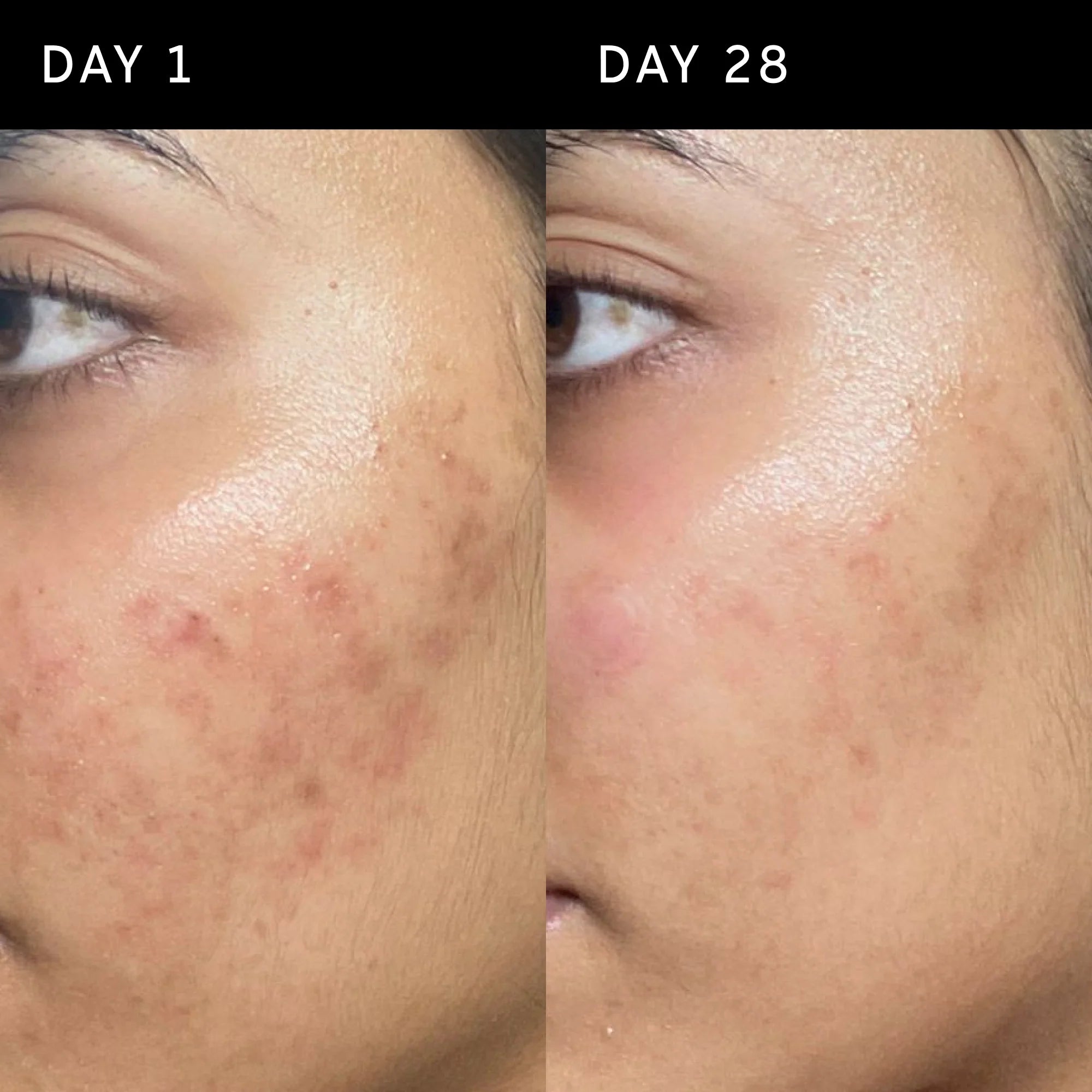 The Inkey List Ectoin Hydro-Barrier Serum