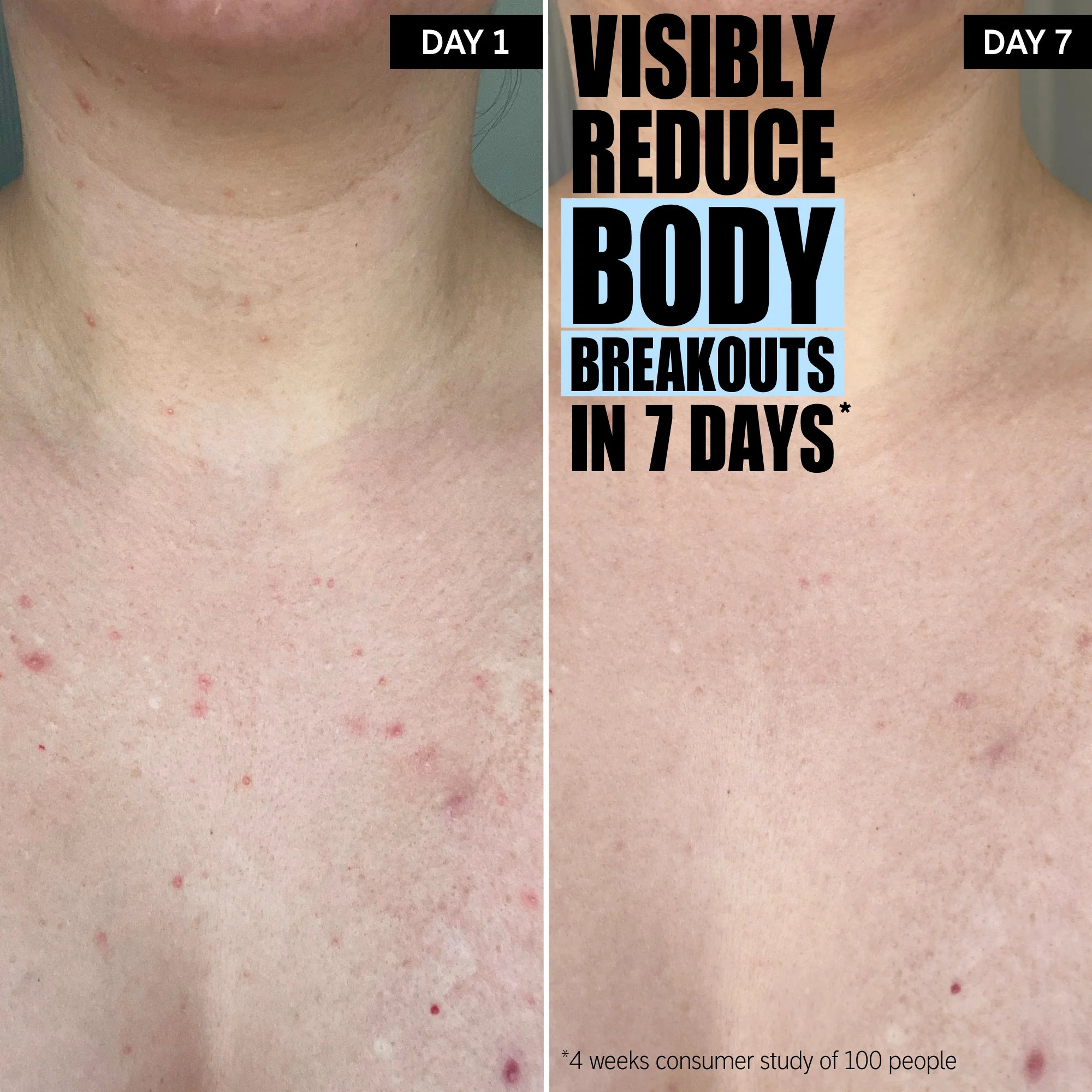 The Inkey List Glycolic Acid Exfoliating Body Stick