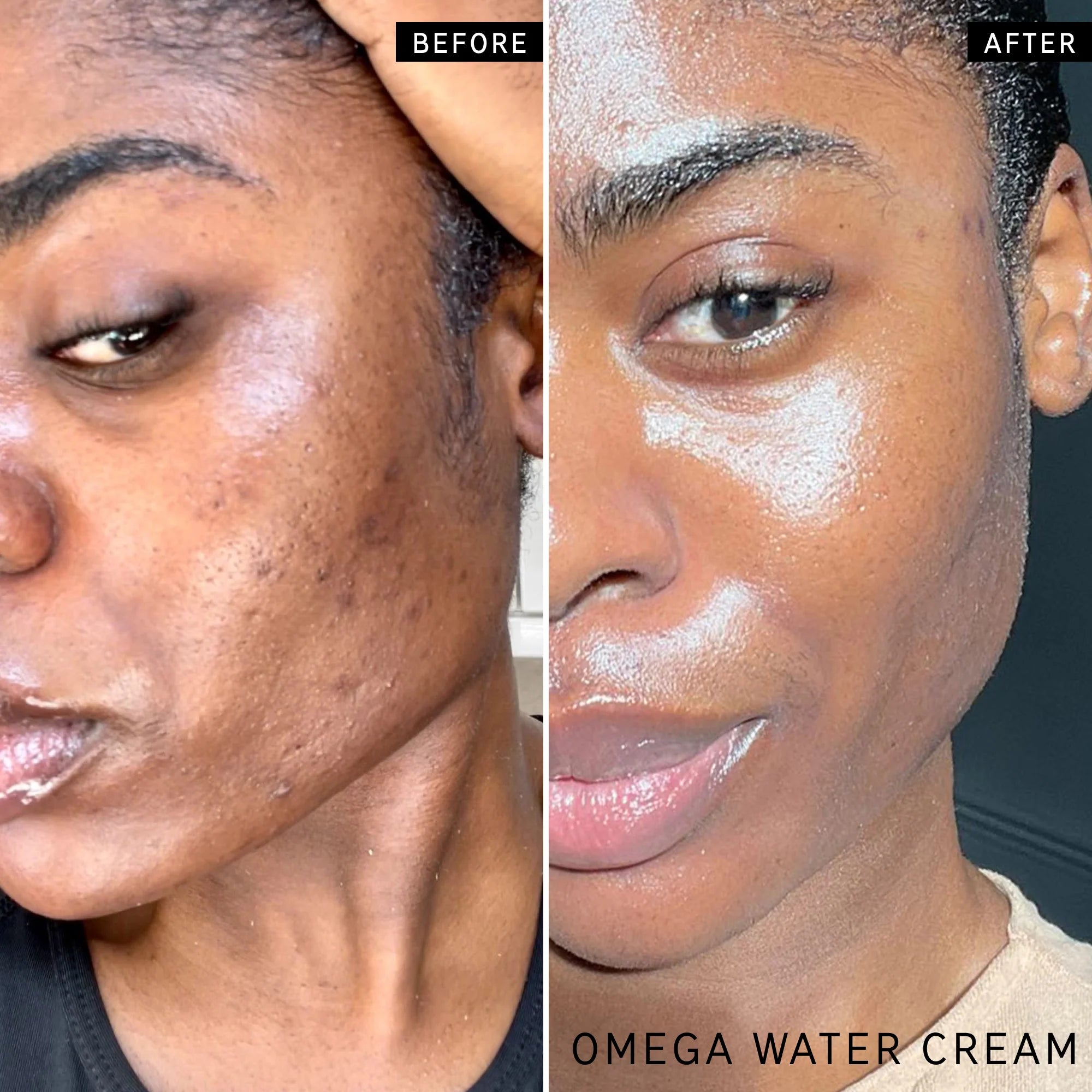 The Inkey List The Moisture Boost Duo to increase skin hydration levels