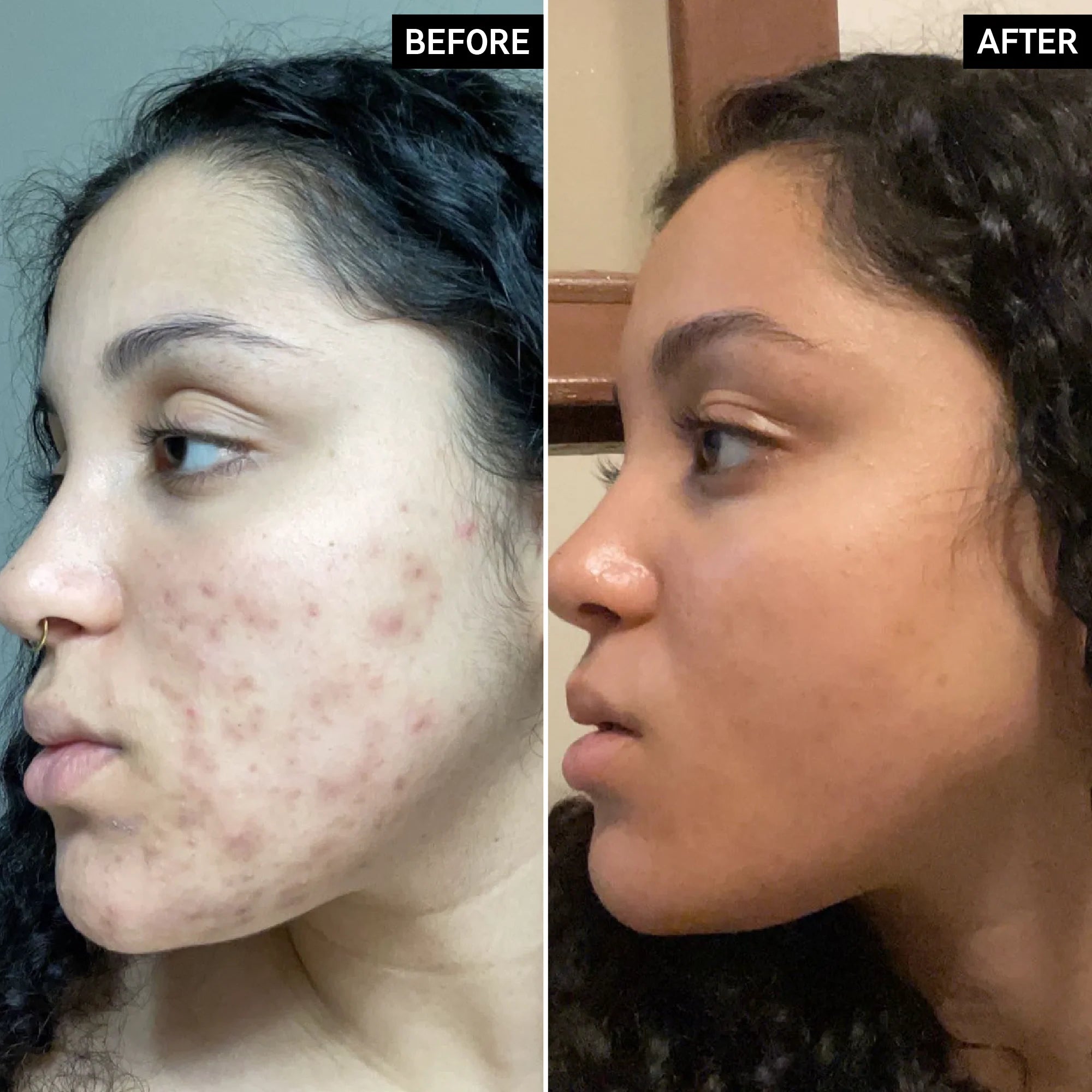 The Inkey List Vitamin C Serum 30%