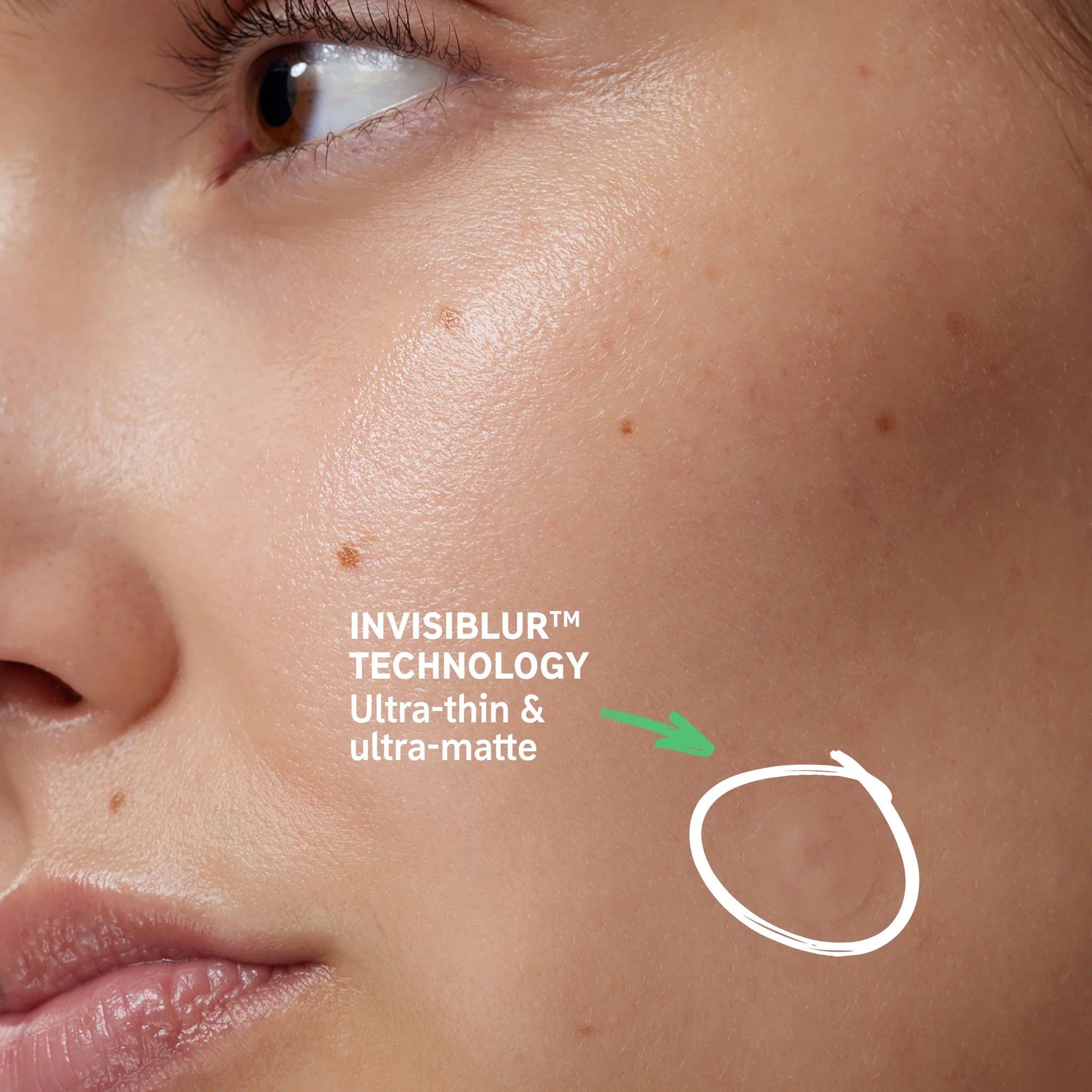 The INKEY List Hydrocolloid Invisible Pimple Patches