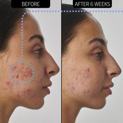 The Inkey List Scar, Mark and Wrinkle Solution - 1% Retinol Serum