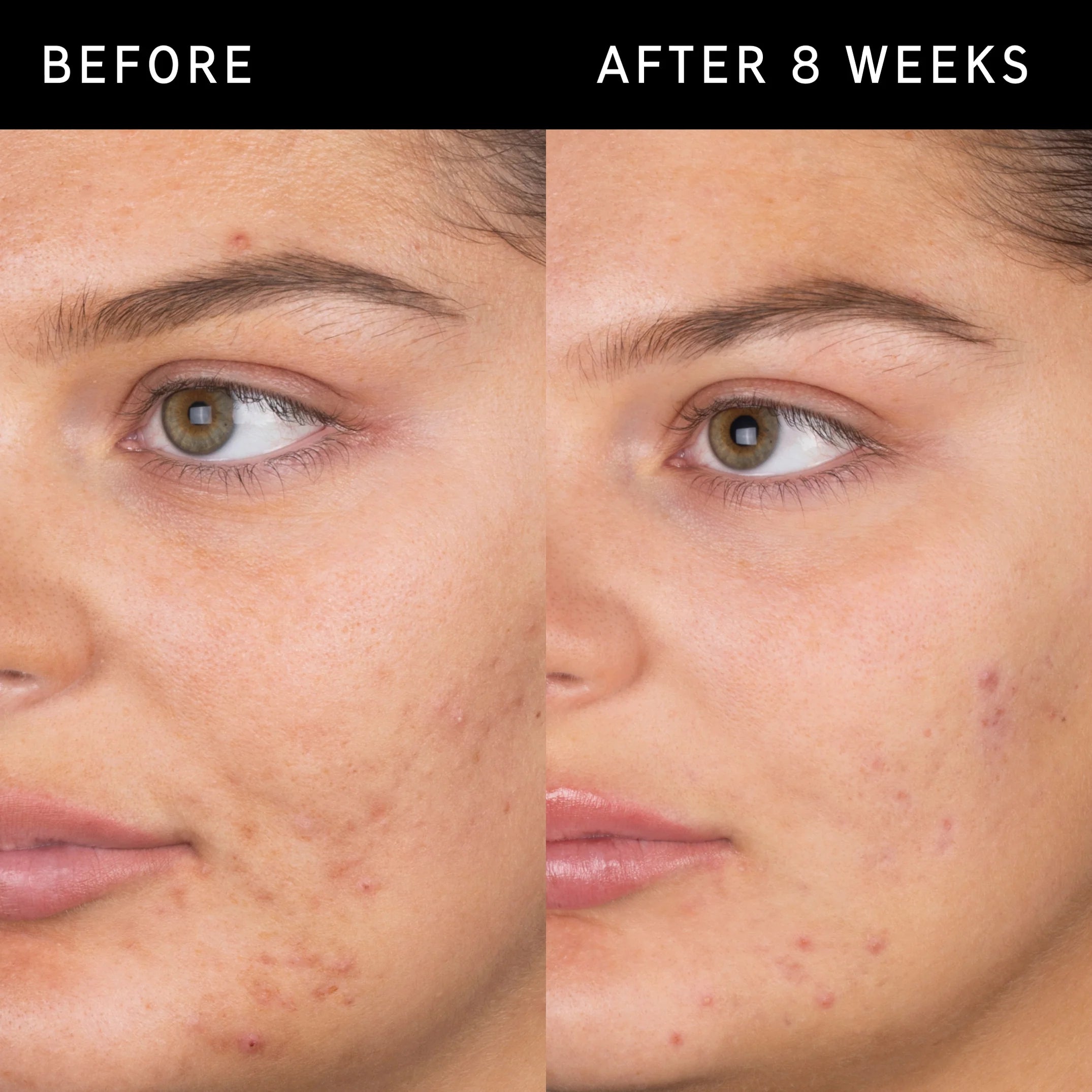 The Inkey List Salicylic Acid Cleanser