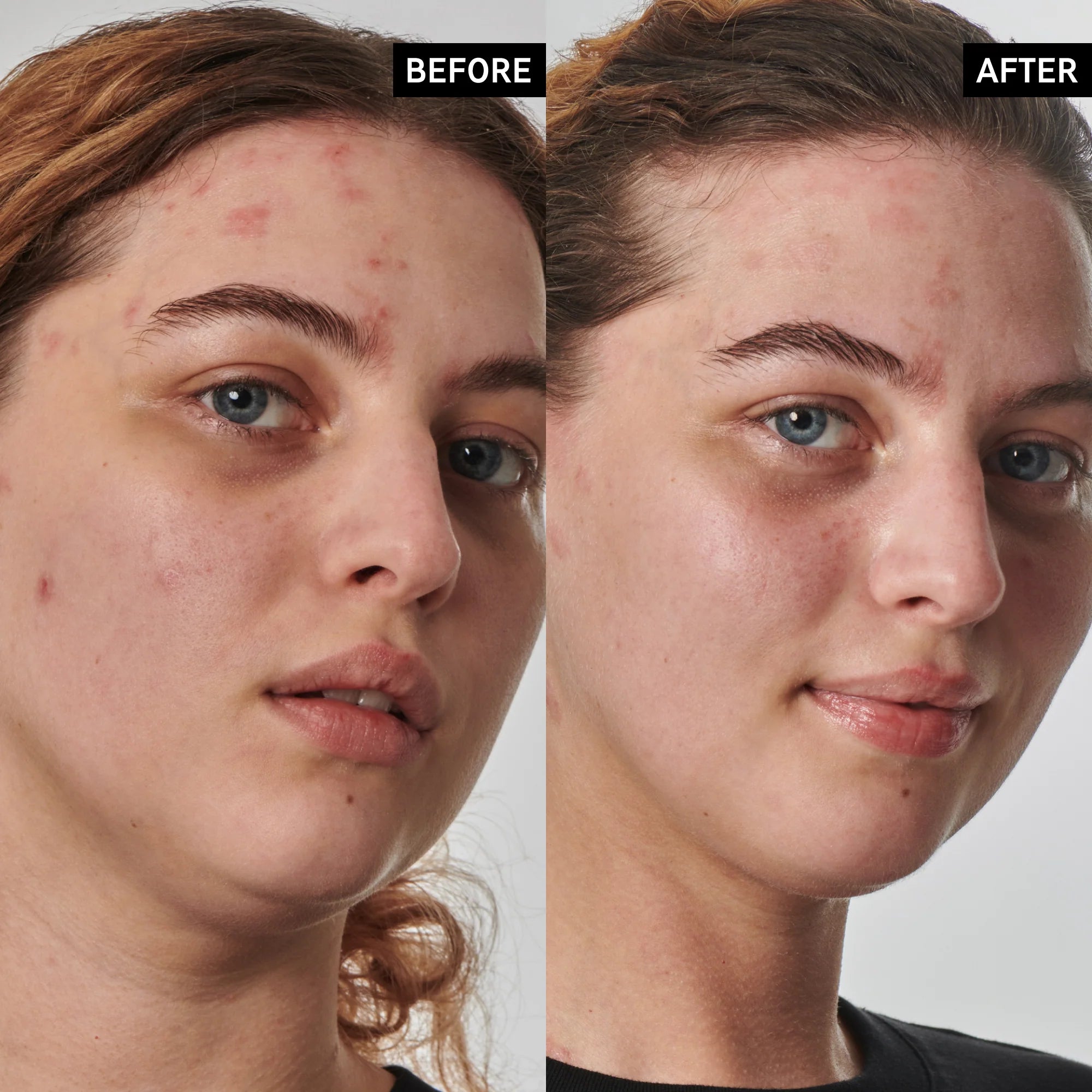 The Inkey List Urea Moisturiser