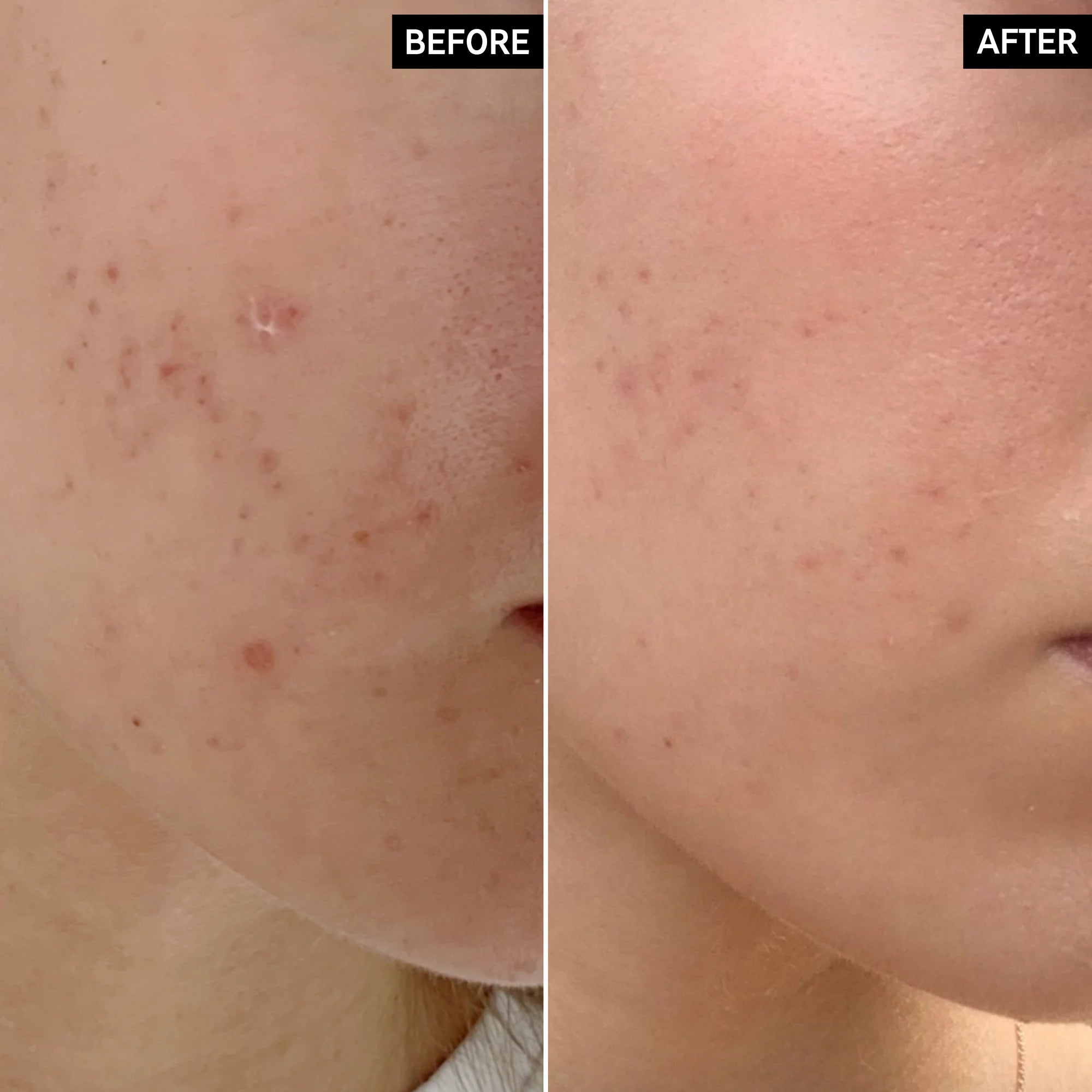 The Inkey List Mandelic Acid Treatment