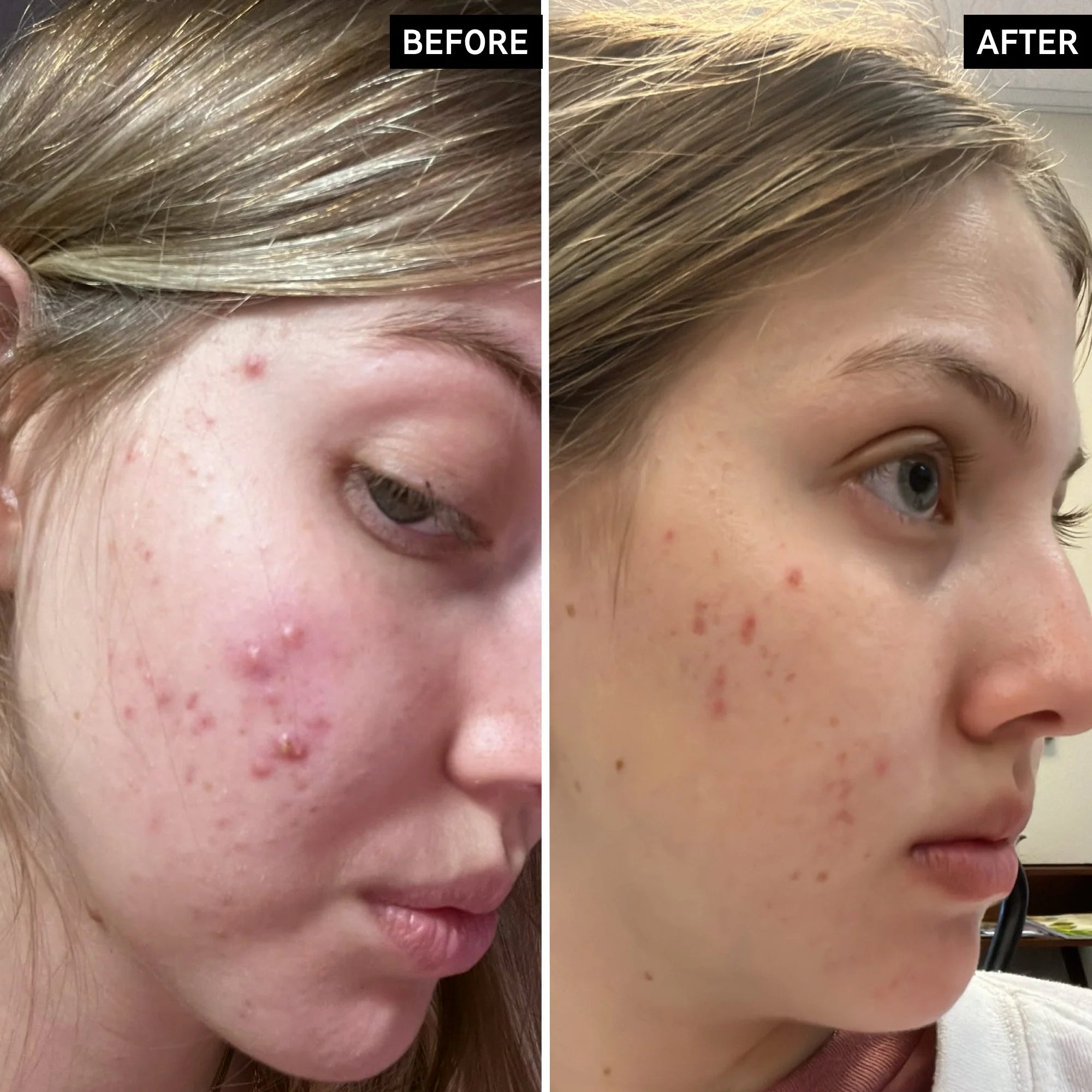 The Inkey List Salicylic Acid Cleanser