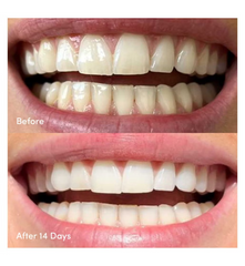 Gem Whitening Strips, 28 Satches